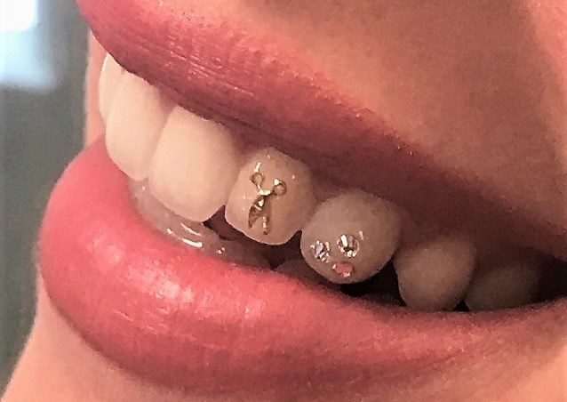 Gold Gems Gallery – Swarovski Tooth Crystals & Tooth Jewelry