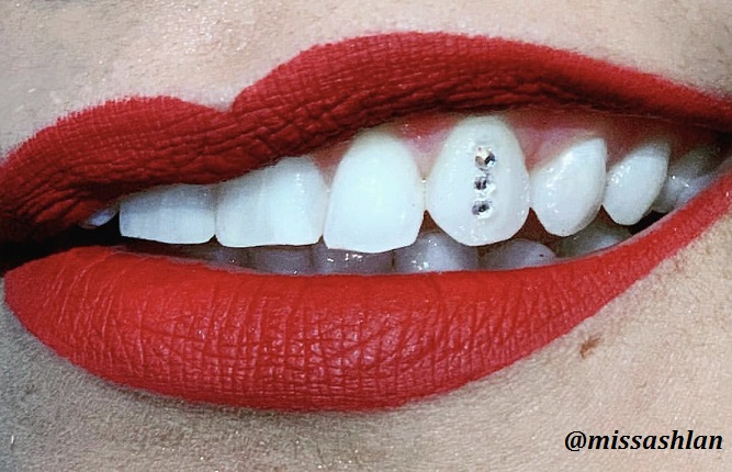 Light-Cure Dental Adhesive, Translucent – Swarovski Tooth Crystals