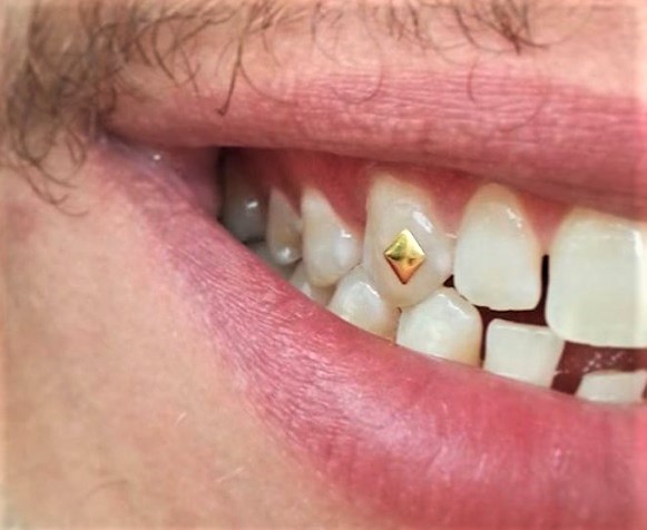 Download - Trebbih Inc.'s Gold Tooth Gems