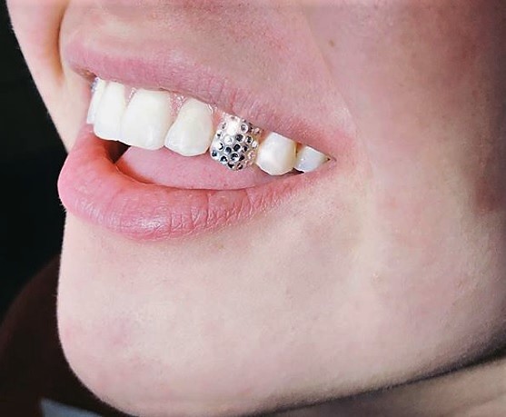 Swarovski Tooth Crystals & Tooth Jewelry – trebbih inc.