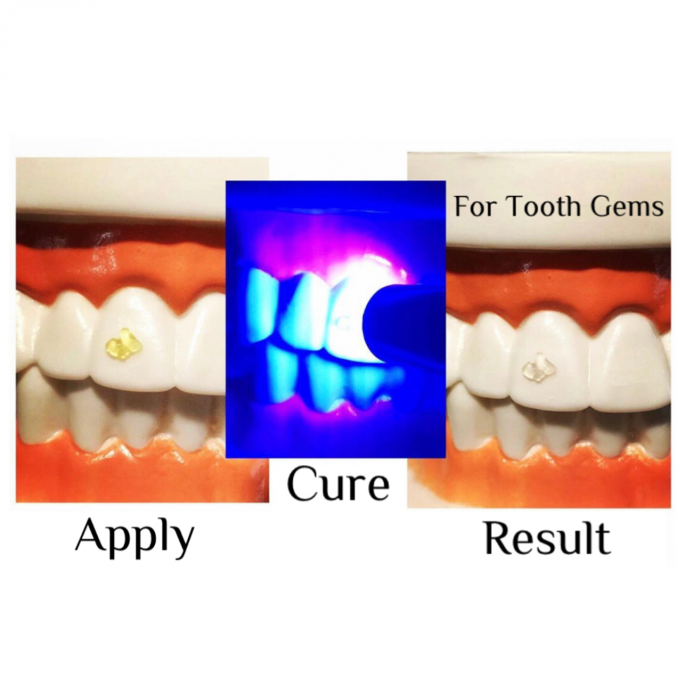  Tooth Gem Glue