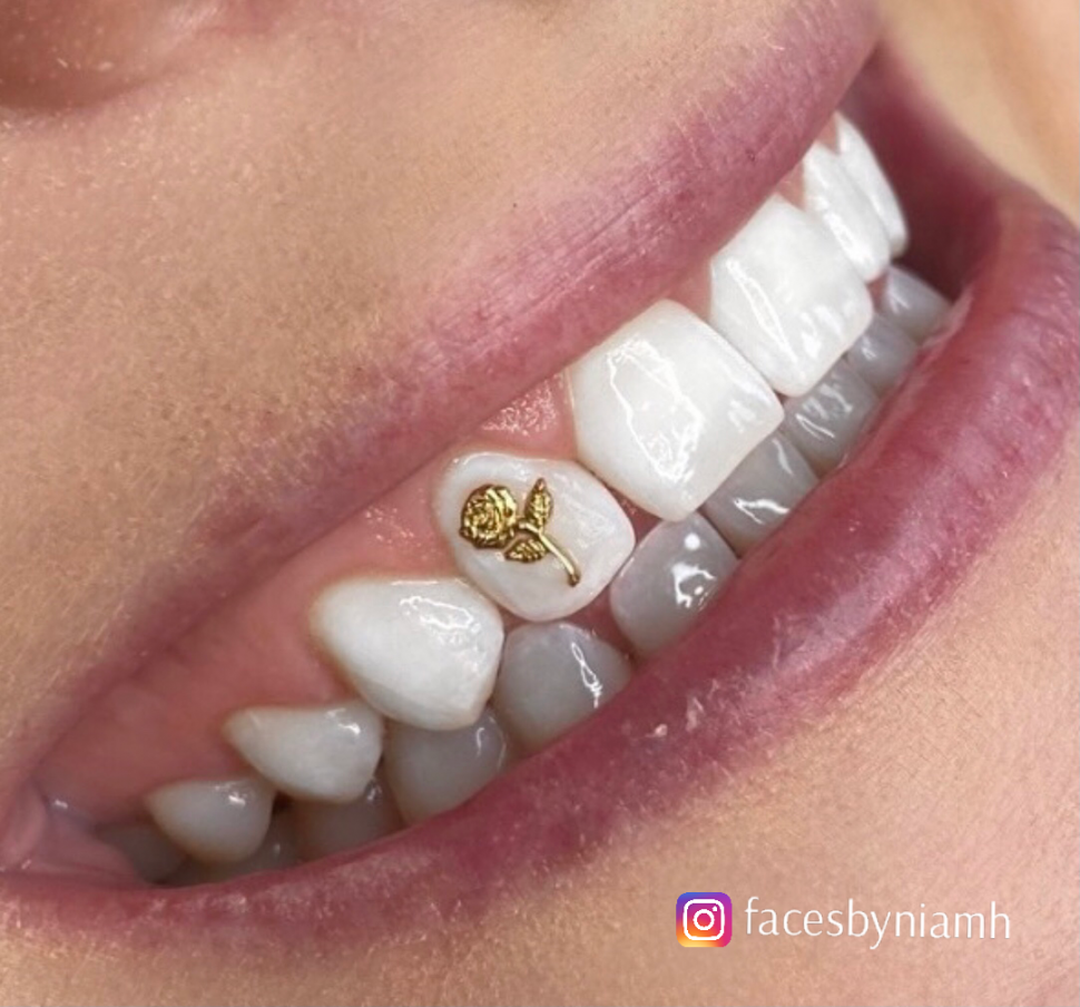 What You Should Know Before Getting Tooth Gems