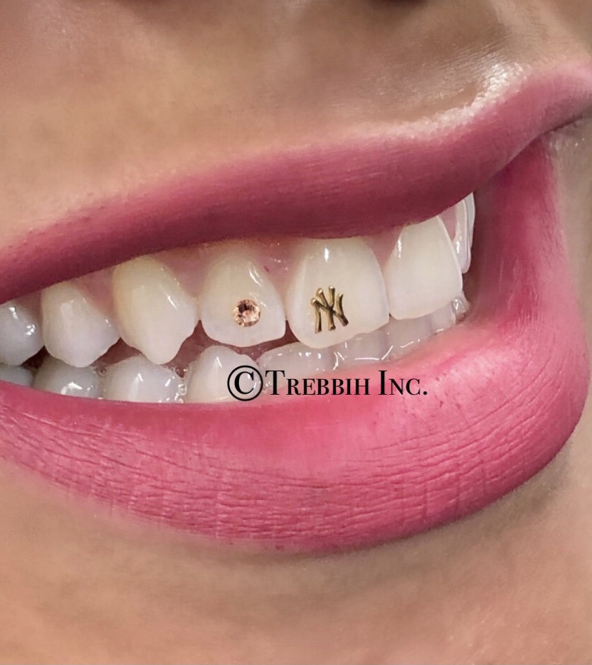 Tooth Jewelry, Houston Tooth Gems