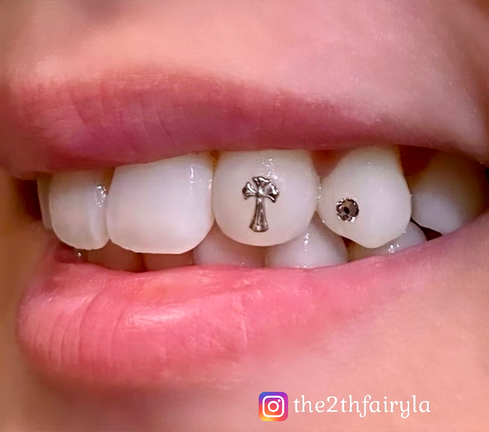 Houston Tooth Gems — Battle Royale Tattoo