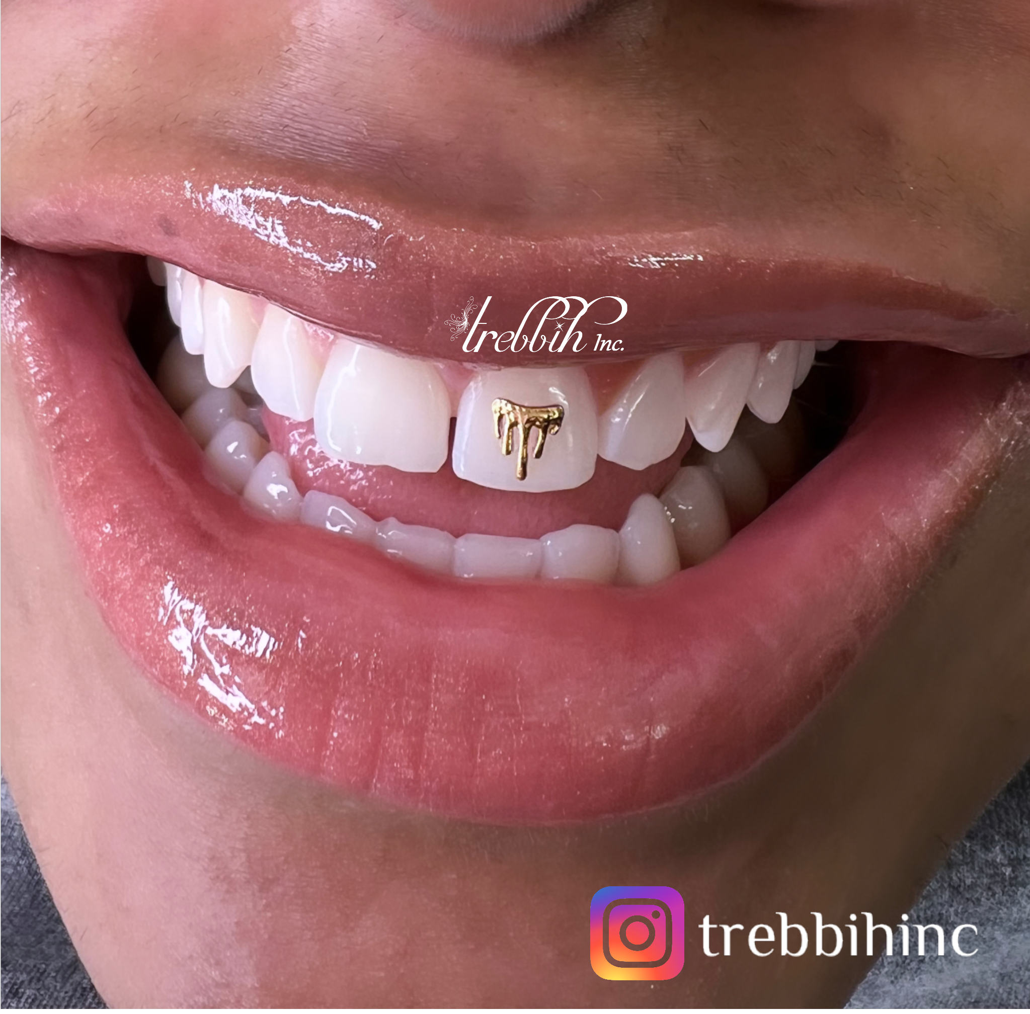 Respect Onafhankelijk Word gek Drip Tooth Gem – Swarovski Tooth Crystals & Tooth Jewelry