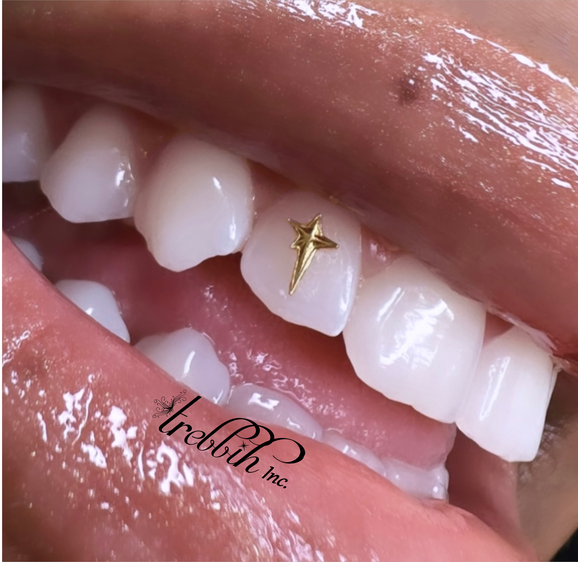 Tooth Gems – Tish Lyon